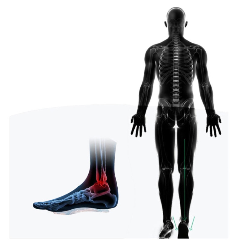 Innersåle Flat Foot Support Innleggssåler med høy hæl smertelindring - L